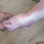 opieka seniora - zdjęcie ogłoszenia 55 latka złamała noge i trzeba zadbać o jej higienę 